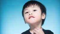 Penyakit Kulit pada Anak: Panduan Lengkap untuk Orang Tua