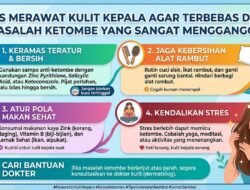 Tips Merawat Kulit Kepala Agar Terbebas Dari Masalah Ketombe Yang Sangat Mengganggu